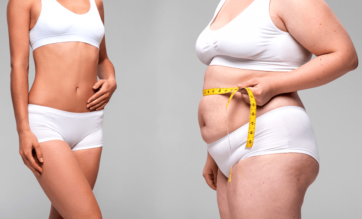 Effect of the Keto diet for weight loss